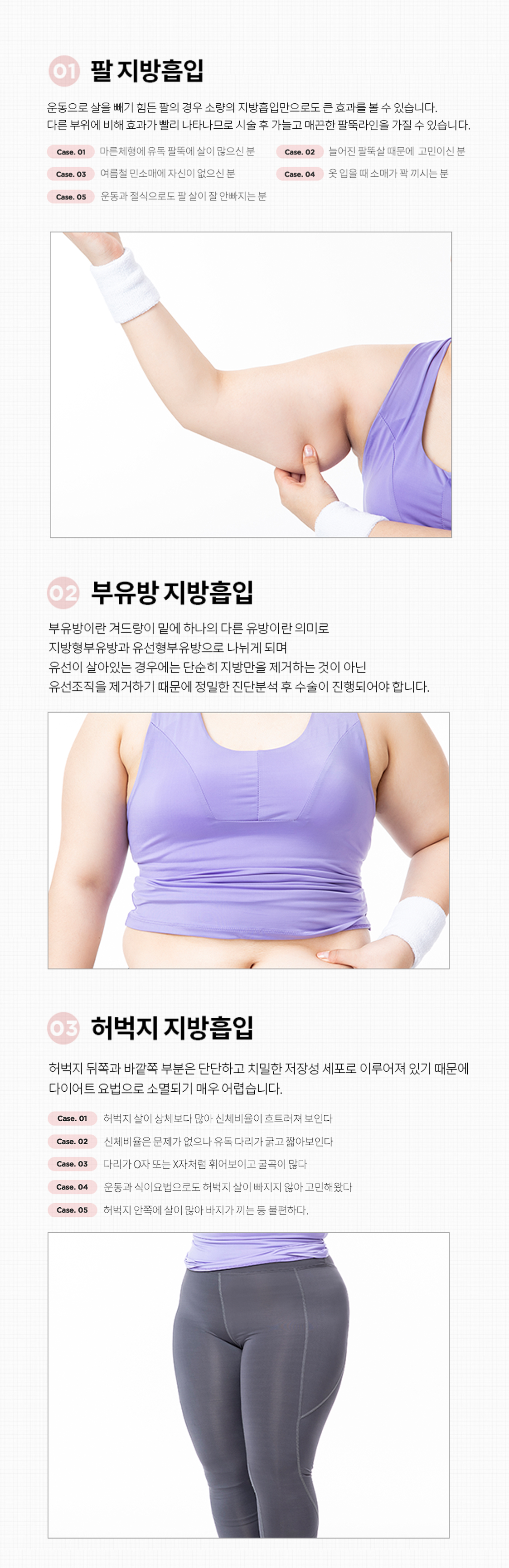 지방흡입수술